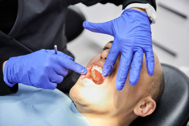Best Emergency Dental Extractions in Shenandoah, LA